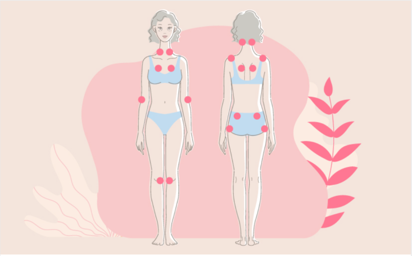 Mutuelle Mieux-Etre fait le point sur la fibromyalgie.